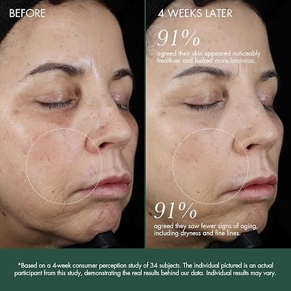 RéVive Intensité Volumizing Serum, Anti-Aging Face Serum for the Appearance of Volume Loss, Fine Lines & Wrinkles, with RV Volumizing Peptide, Skin Support Complex & Ceramide Blend, 30 ml / 1 oz