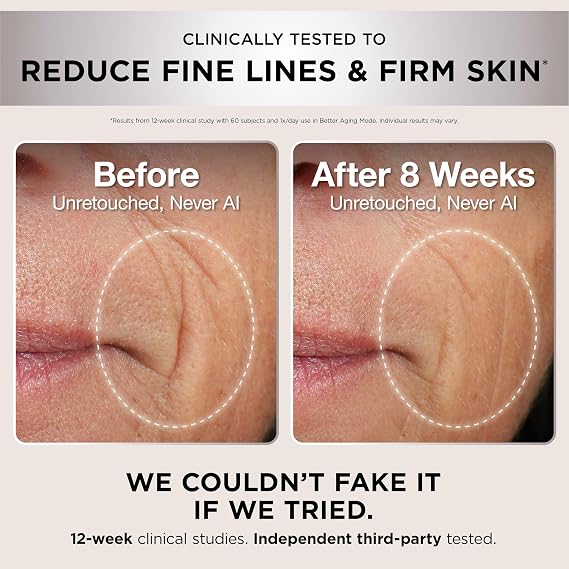 Shark CryoGlow LED Face Mask, Red Light Therapy, Under-Eye Cooling, FW312PL Red, Blue & Deep Infrared Light, Skincare Device for Fine Lines & Acne, Clinically Tested & FDA-Cleared, 4 Modes, Lilac